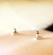 お灸イメージ写真